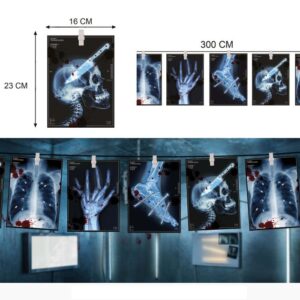 Grinalda Radiografias 300cm
